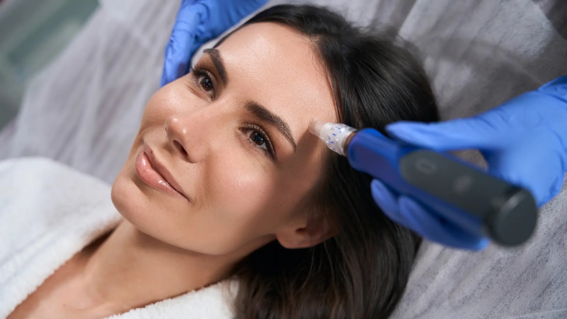 Microneedling: Educational Guide